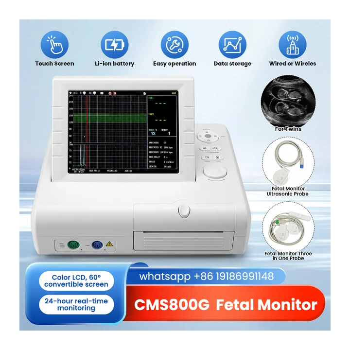 CONTEC CMS800G фетальный доплеровский ультразвуковой монитор 24 часа рекордер пренатальный монитор сердечного ритма движение FH